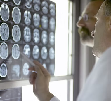 Doctor reviewing X-ray scans